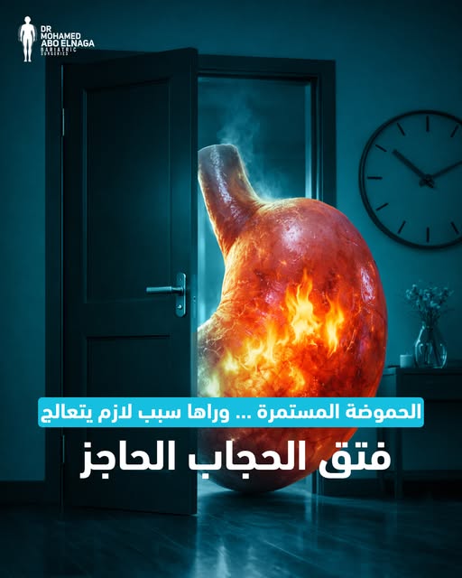 عملية-فتق-الحجاب-الحاجز-بالمنظار
